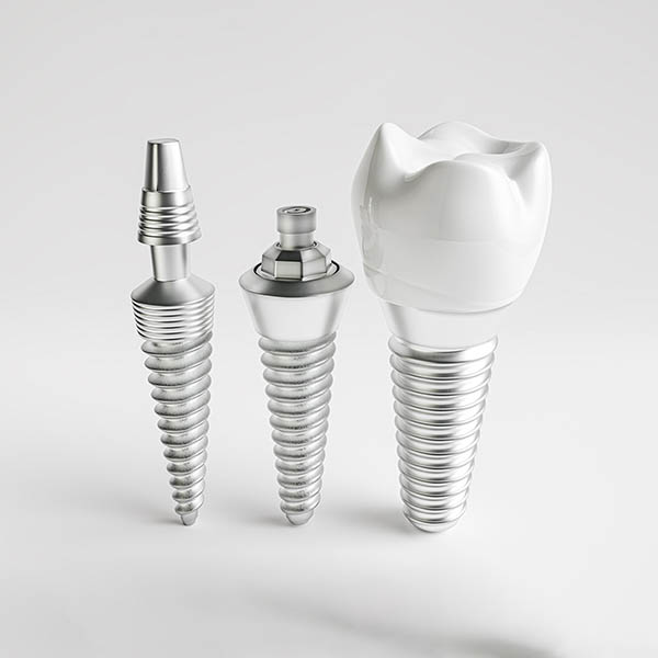 dental-senses_offer-007_img_02_s.jpg